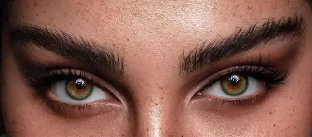 fox eyes botox