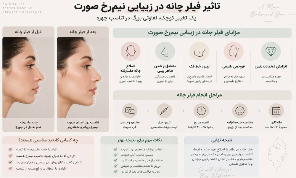تاثیر فیلر چانه 